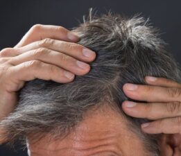 Saçın Erken Beyazlaması Doğal Olarak Nasıl Tedavi Edilir? | Dr. Berg Türkçe